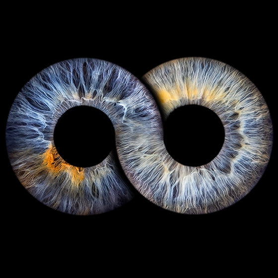 Iris-Bundle: 2 Iriden inkl. Design mit Acrylglas (60 × 40 cm)